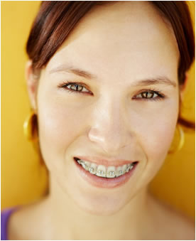 orthodontic faqs